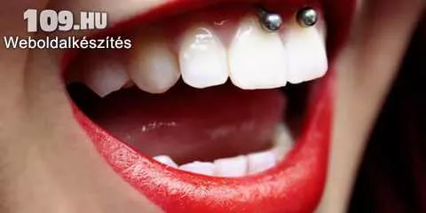 Ínyfék, nyelvfék piercing (Smiley)
